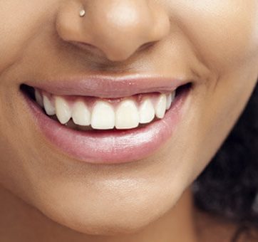 Dentist Describes Dental Crown and Bridge Procedures